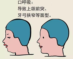 哈尔滨微整培训